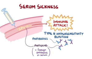 What is Serum Sickness